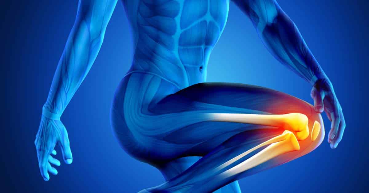 Knee Arthroscopy At Bimc