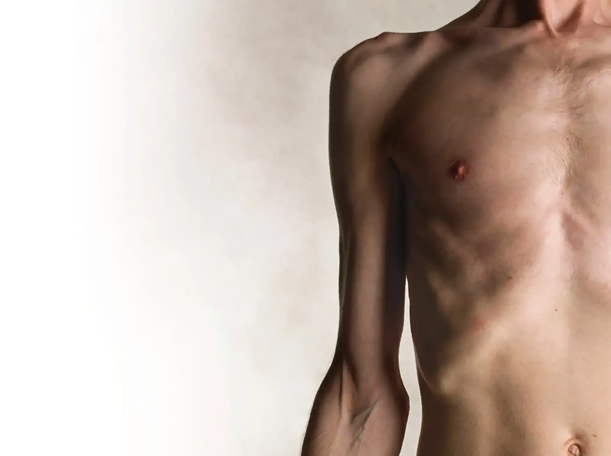 Malnutrition In Adults Copy