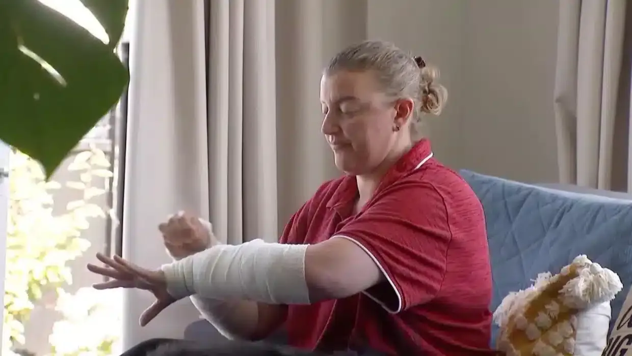 Severe Burns Res 1