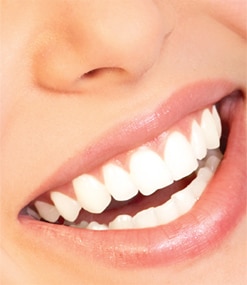 Teeth Whitening