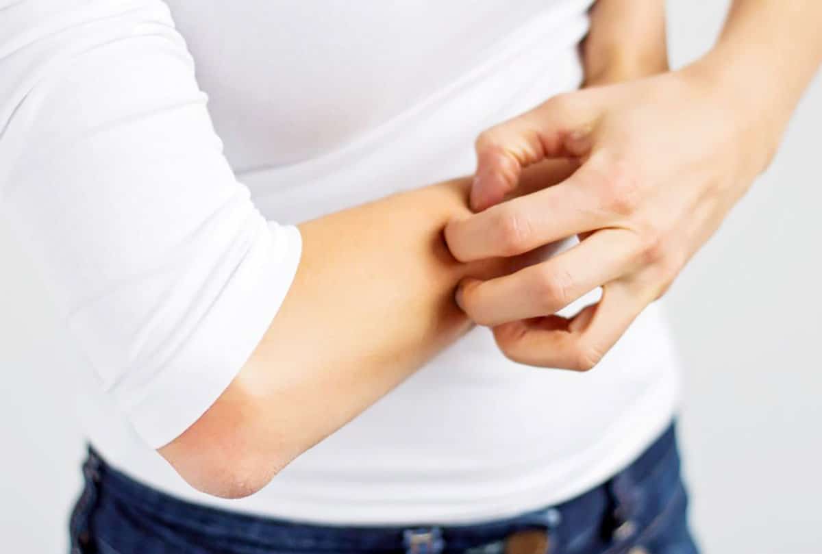 The Prevalence of Bedbugs on the Rise