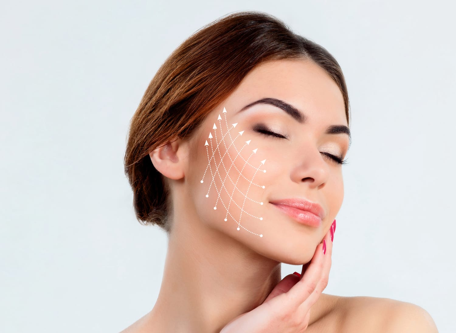 Thread Lift Agar Wajah Awet Muda