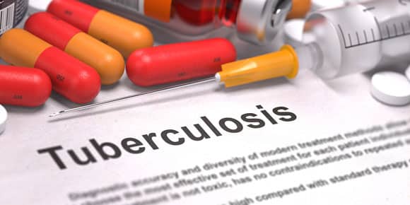 Tuberculosis web