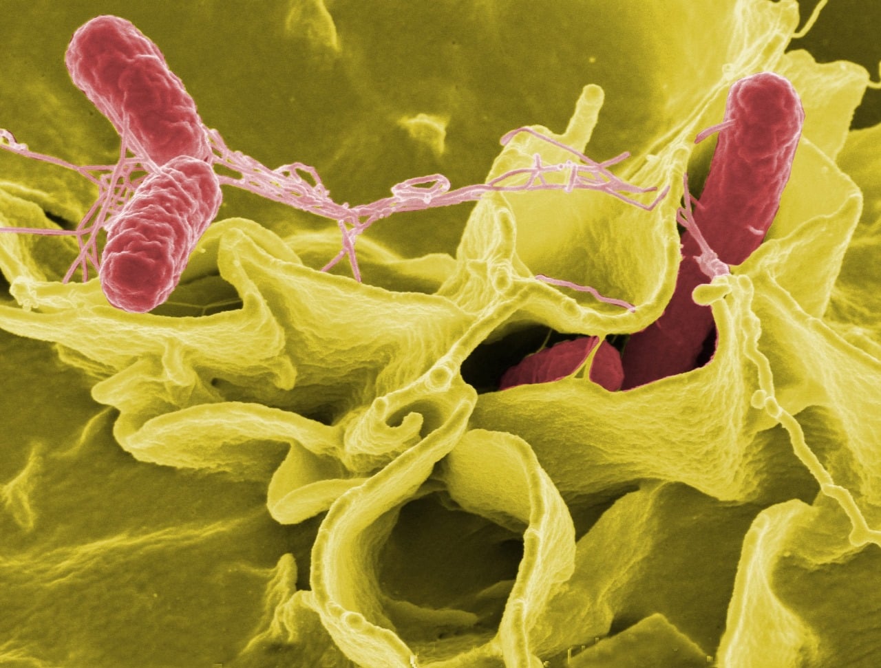 Typhoid Fever