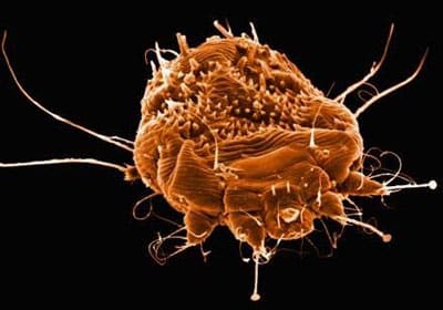 biopara-scabies