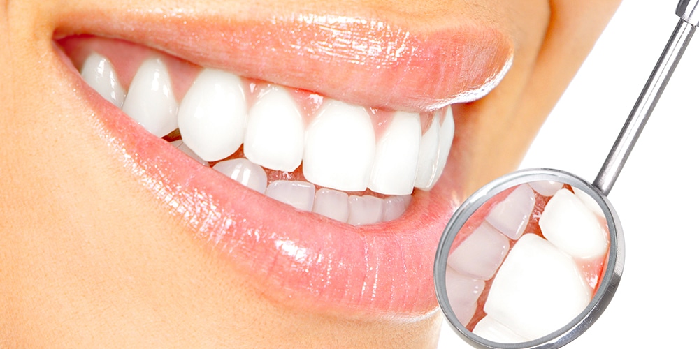 clean-dental