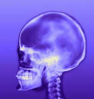 concussion - BIMC Hospital