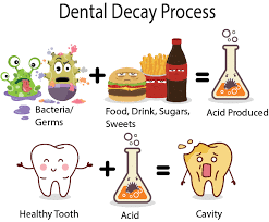 Dental Decay Proses