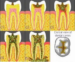Dental
