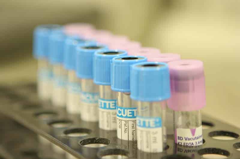 test-tube-prodia