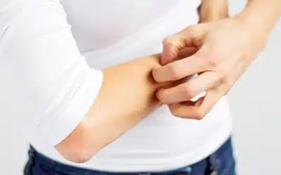 The Prevalence of Bedbugs on the Rise