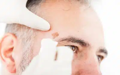 Australia’s National Cancer