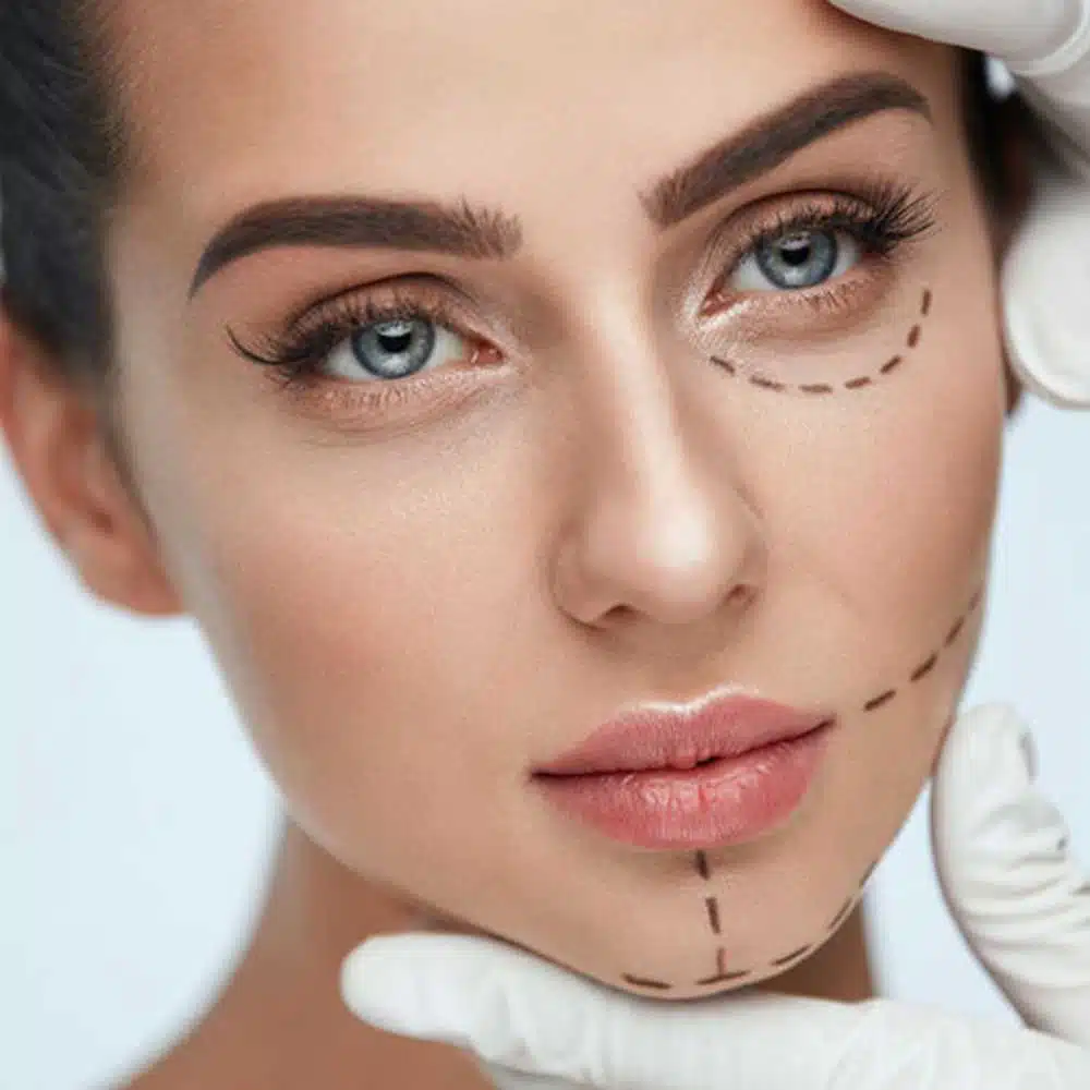 Chin Augmentation Chin Augmentation