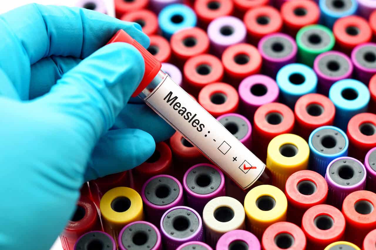 Surge In Worldwide Measles Deaths