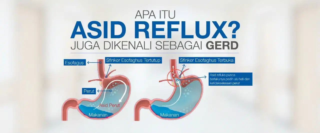Bimcnd Header Landing Page Gerd 3