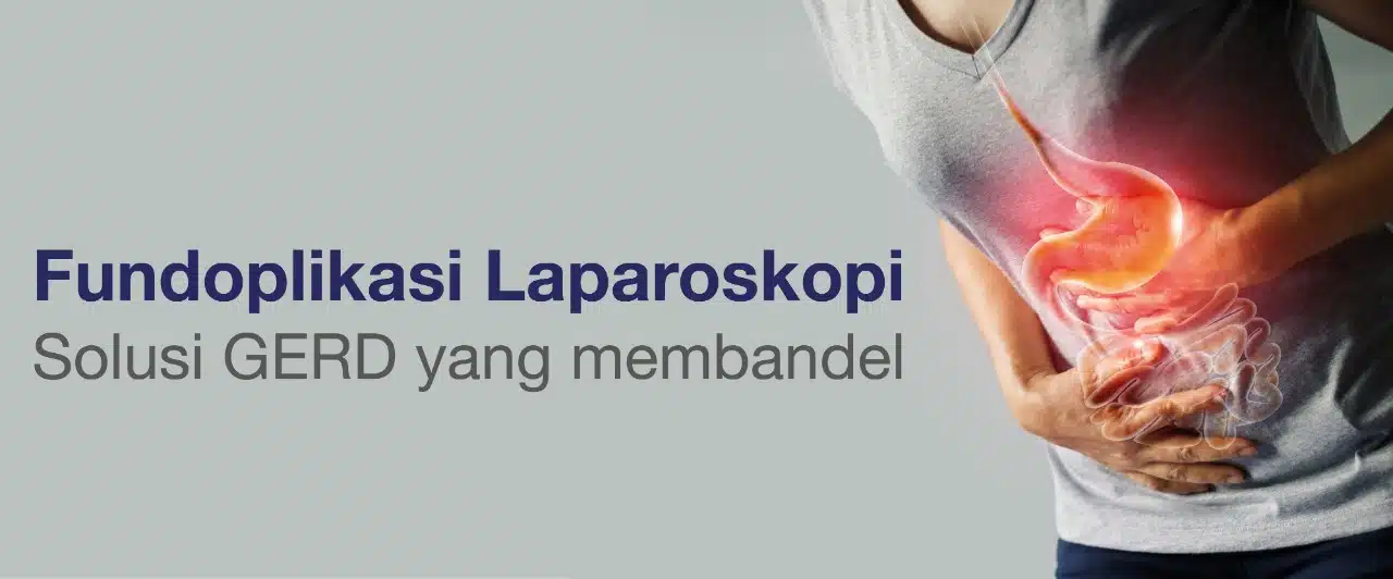 Bimcnd Header Landing Page Gerd