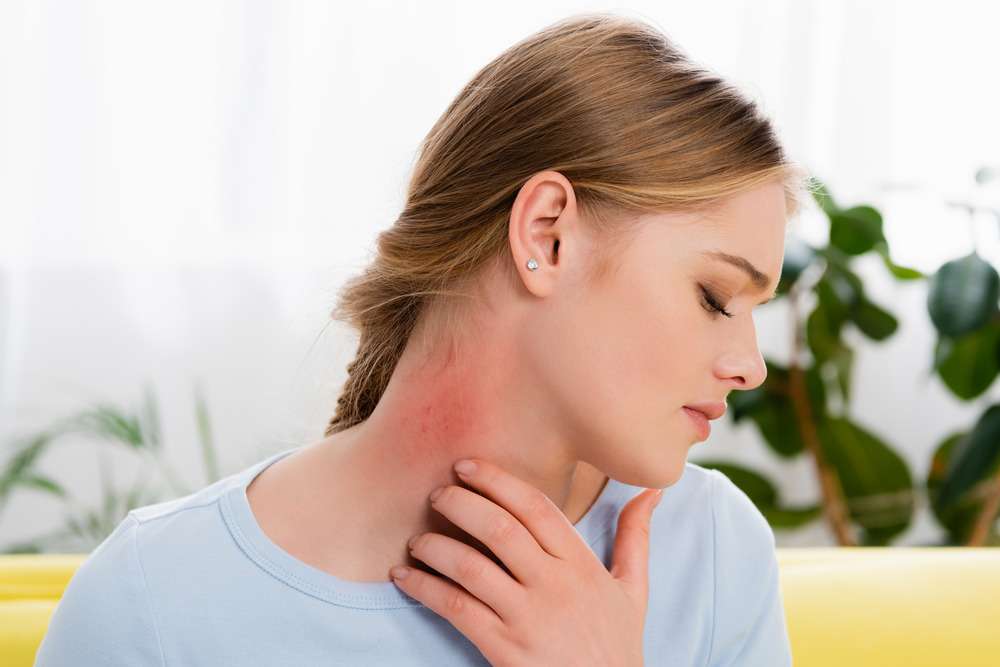 Anaphylaxis Res