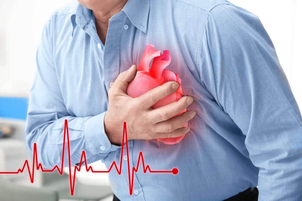 Heart Attack Res
