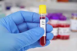 Std Screening