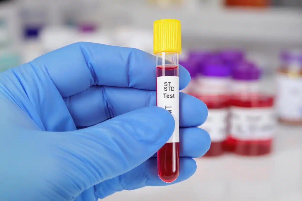 Std Screening