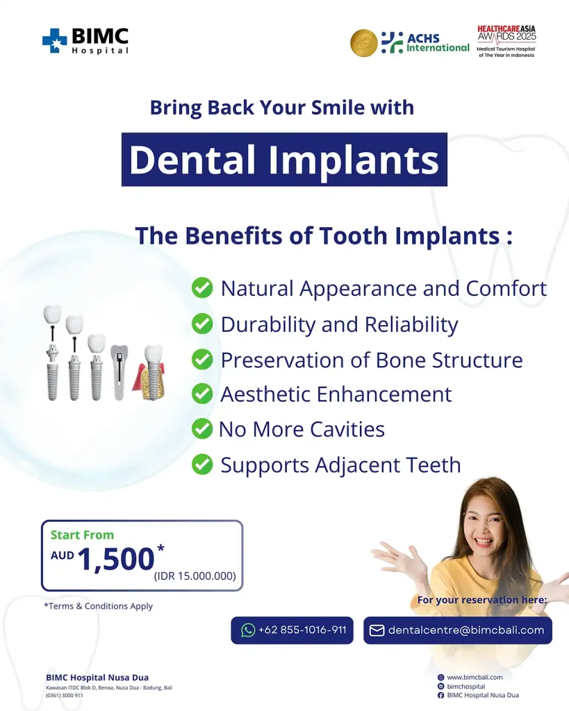 Dental Implant Copy
