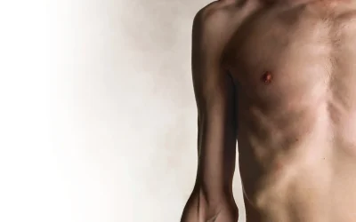 Malnutrition In Adults Copy