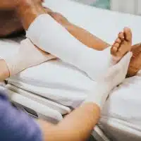 How To Handle A Fracture Before Reaching The Hospital